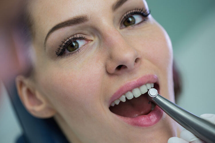 Afyon Diş Taşı Temizleme Tedavisi